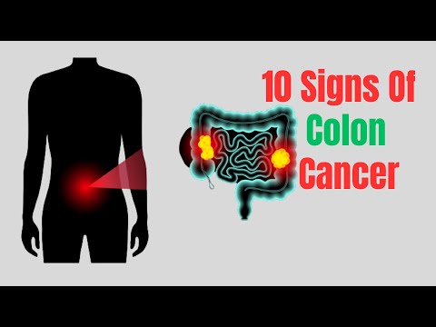 10 Warning Signs Of Colon Cancer - NGF